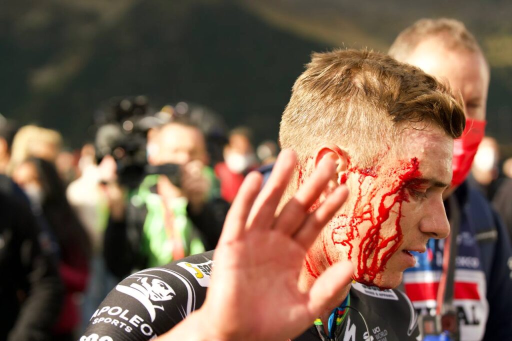 Ремко Эвенпул получил травму после финиша третьего этапа «Вуэльты Испании 2023»