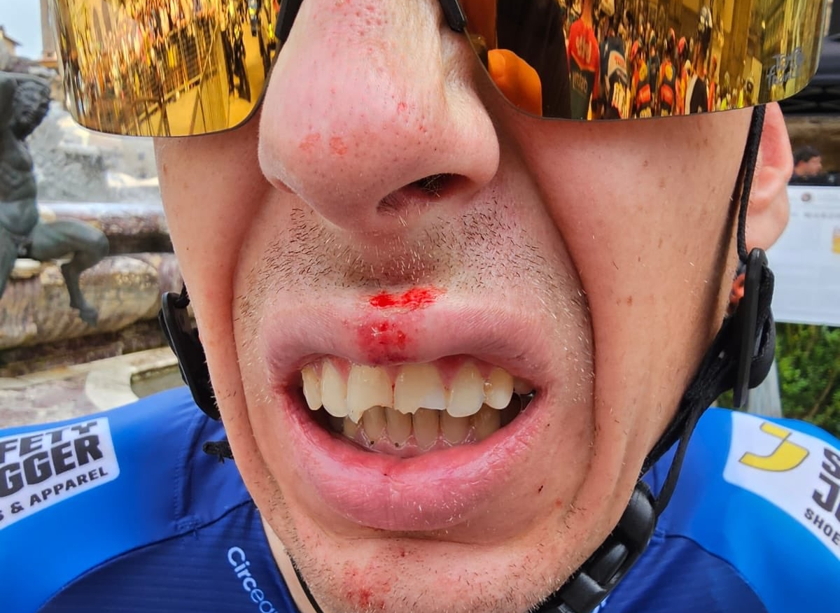 Ян Хирт сломал три зуба за несколько минут до старта «Тур де Франс»